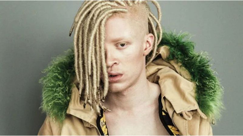 Shaun Ross: pionero albino en la moda